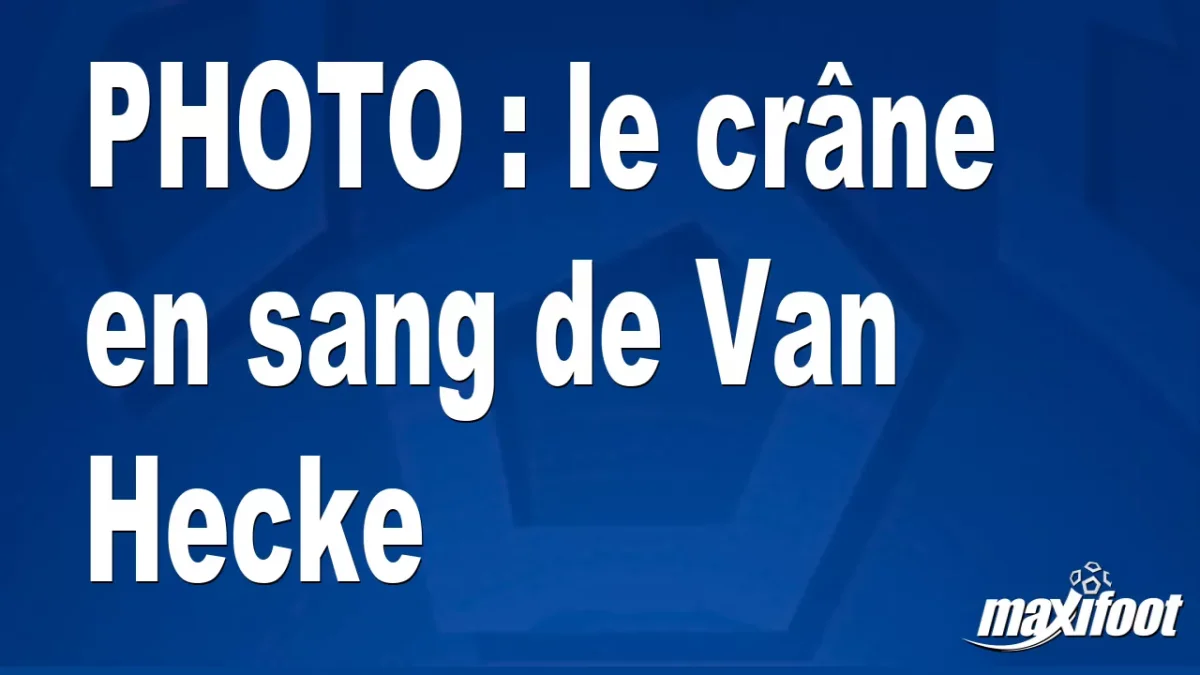 BUZZ : le crâne en sang de Van Hecke