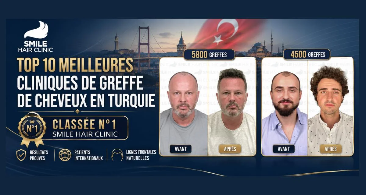 Top 10 des meilleures cliniques de greffe capillaire en Turquie